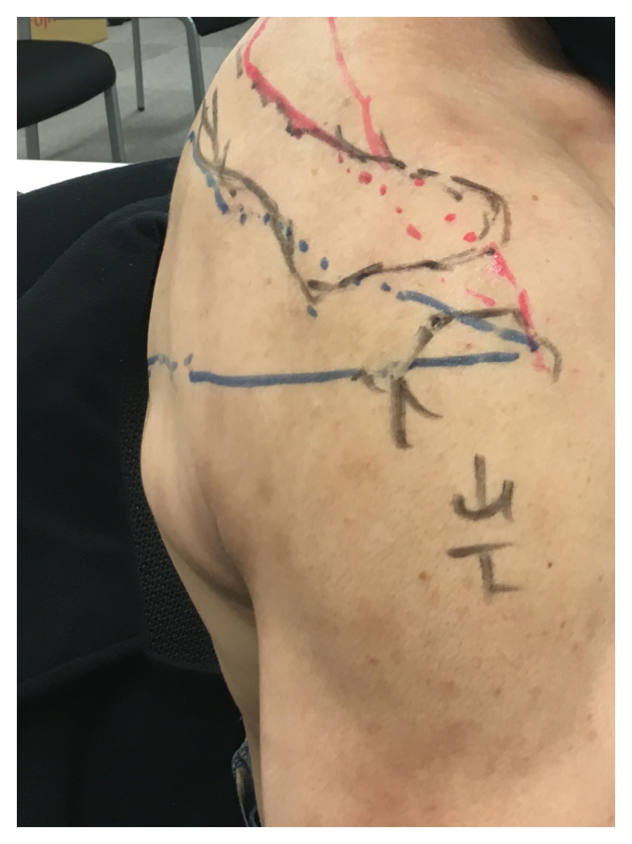 Processed with MOLDIV